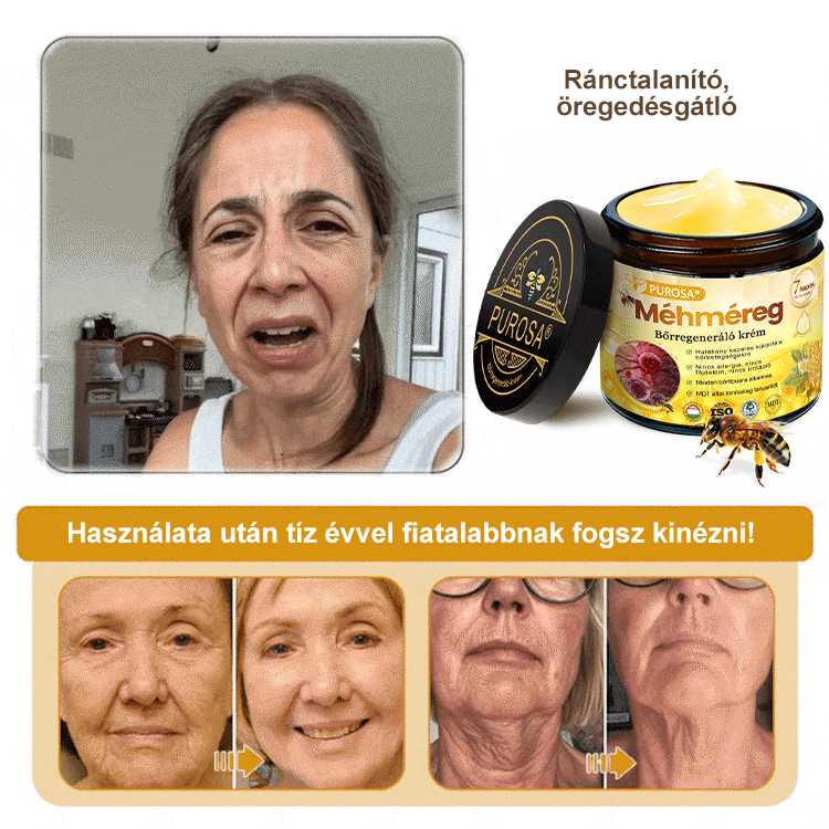 🐝PUROSA® Obnovující krém s včelím jedem|✅Kompletní řešení pro odolné kožní problémy, jako je stárnutí, ekzém, jizvy a lupénka