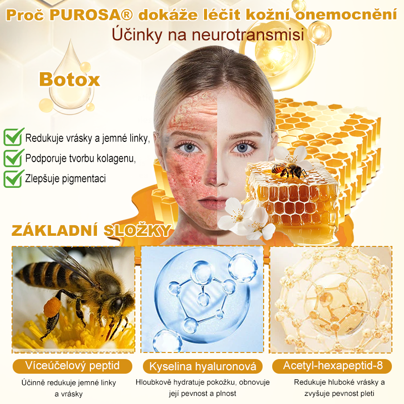🐝PUROSA® Obnovující krém s včelím jedem|✅Kompletní řešení pro odolné kožní problémy, jako je stárnutí, ekzém, jizvy a lupénka