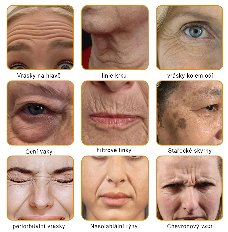 🐝PUROSA® Obnovující krém s včelím jedem|✅Kompletní řešení pro odolné kožní problémy, jako je stárnutí, ekzém, jizvy a lupénka