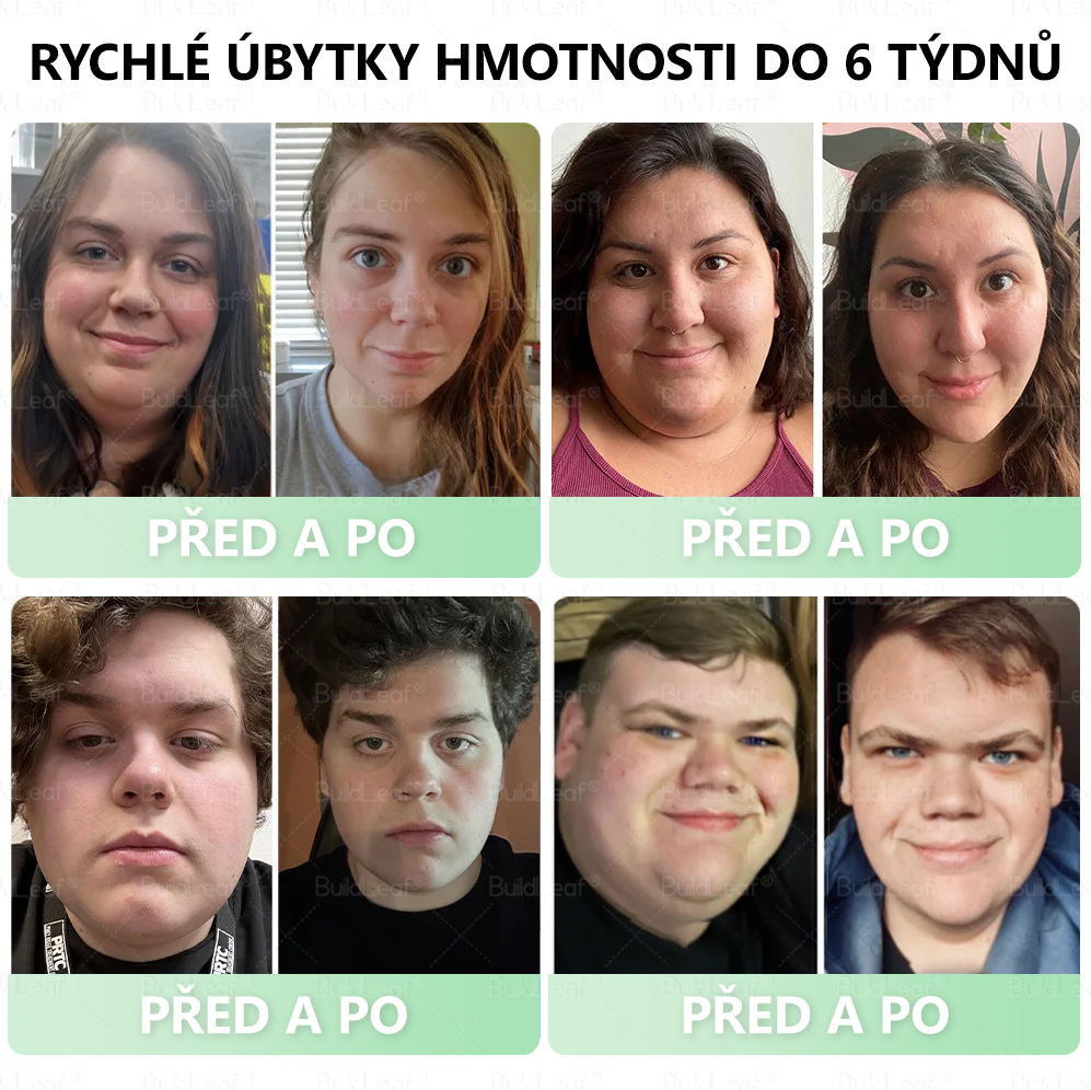 Oficiální doporučení České lékařské komory 💥 | BuildLeaf® TIRZEPATID GLP-1 rostlinného původu v perorálním roztoku